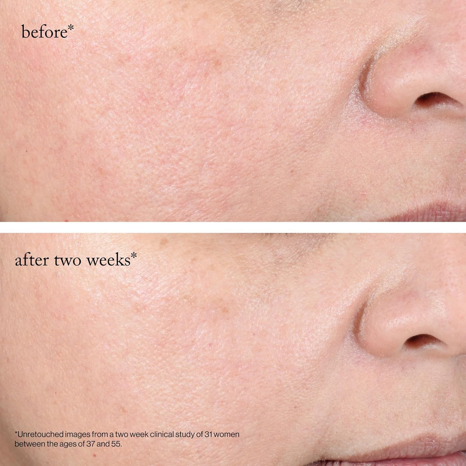 goop Beauty 15% Glycolic Acid Exfoliating Pads | Inspired by a Professional Ch