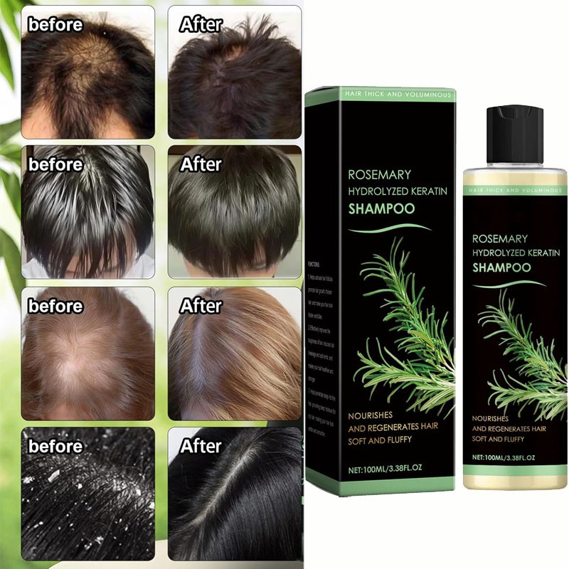 Organic Rosemary Hair Growth Shampoo for Women and Men-Natural Thickening