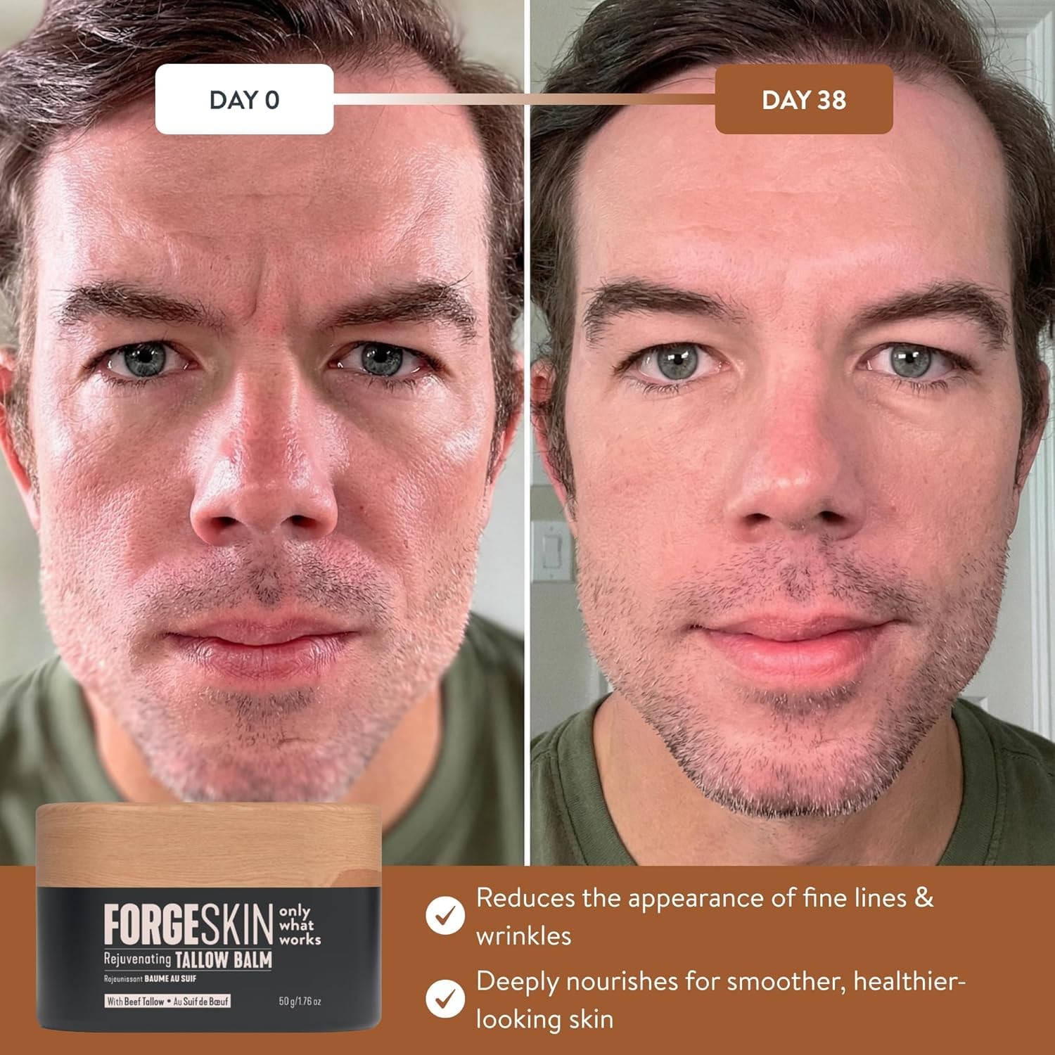 Forge Skin Beef Tallow Balm Moisturizer for Men Skin Care – Face + Body Anti A