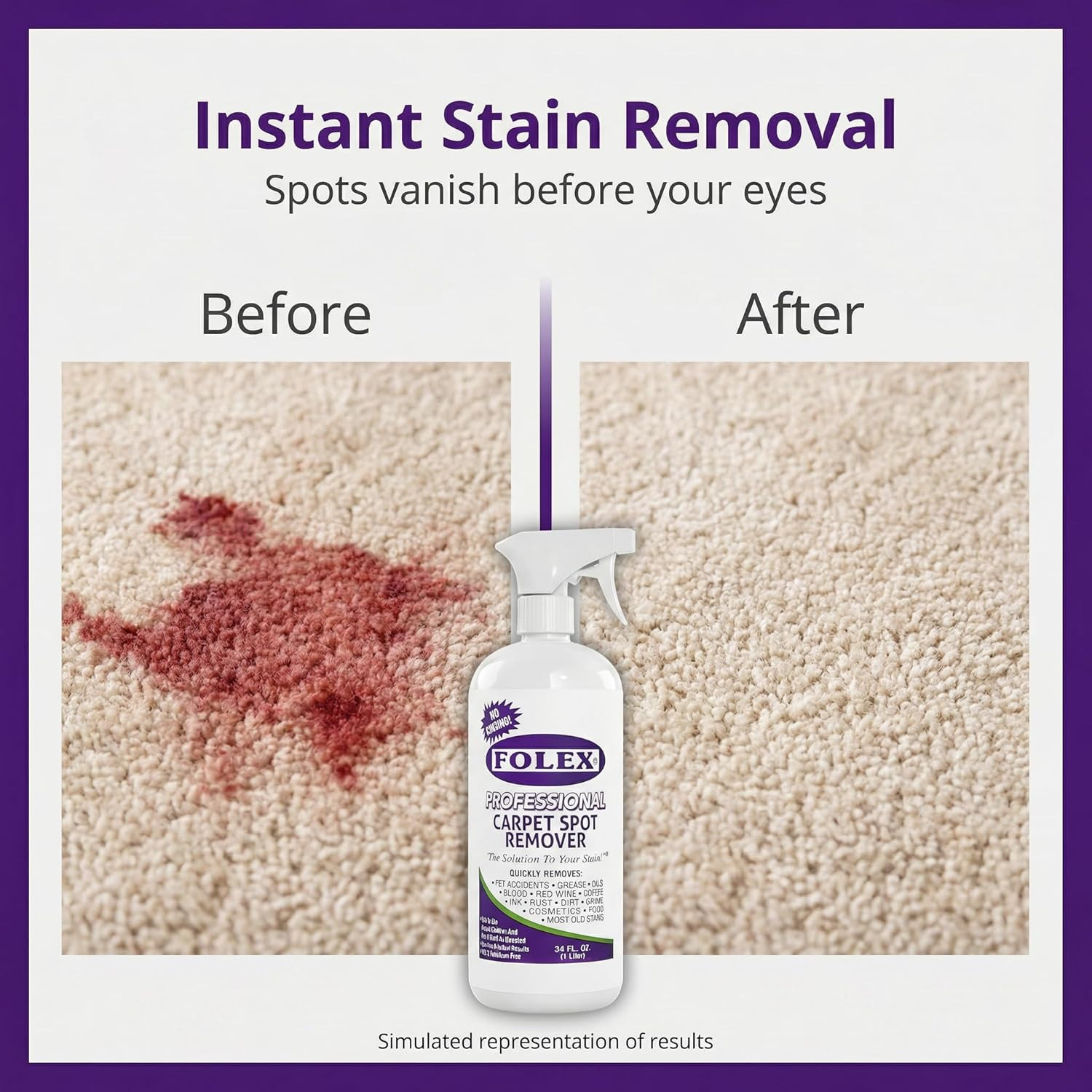 FOLEX – Professional Carpet Cleaner Spray 34 Oz – Pet Stain Removal – Instant St