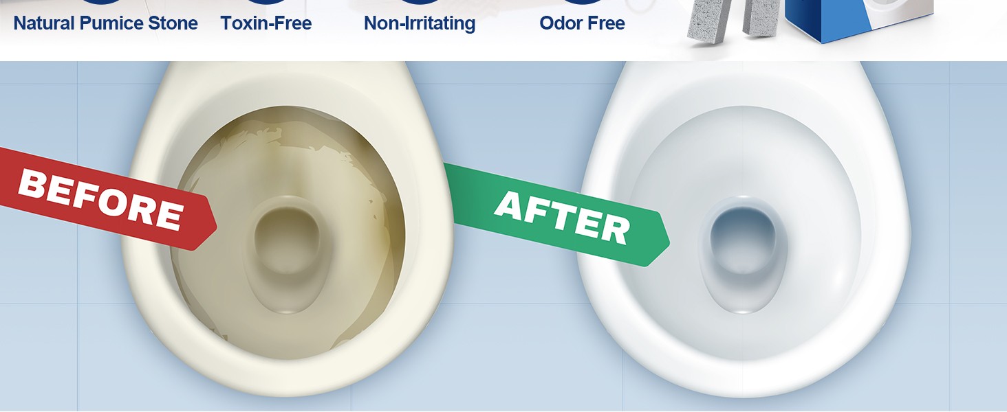 10 Pa Pumice Stone Toilet Bowl Cleaner with 2 Extra Long Handle