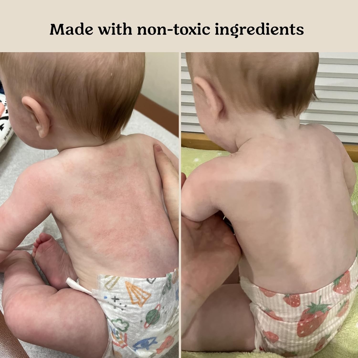 Roe Wellness Baby Cream & Baby Serum Power Pair Biome Barrier | For All Skin &