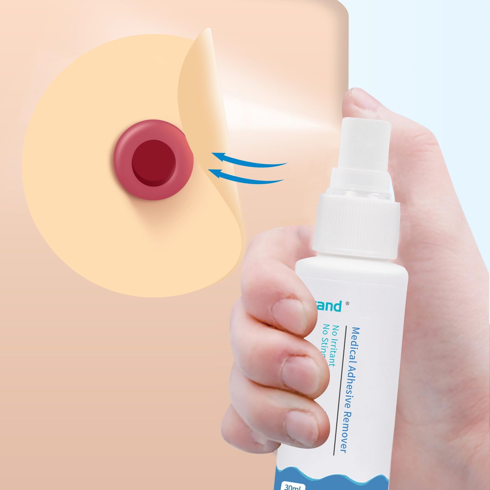 2oz Medical Adhesive Remover,Adhesive Remover Spray for Around Stomas and Wou…