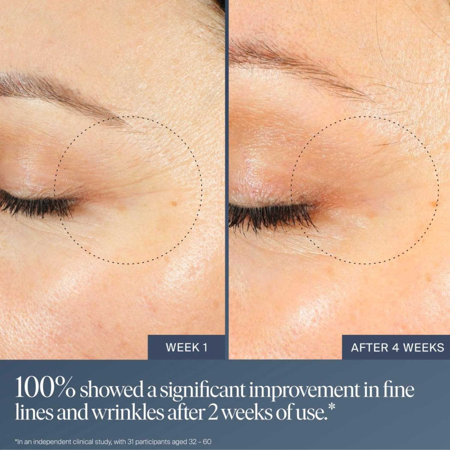 Summer Fridays Jet Lag Overnight Eye Serum – Nourishing Undereye Treatment for