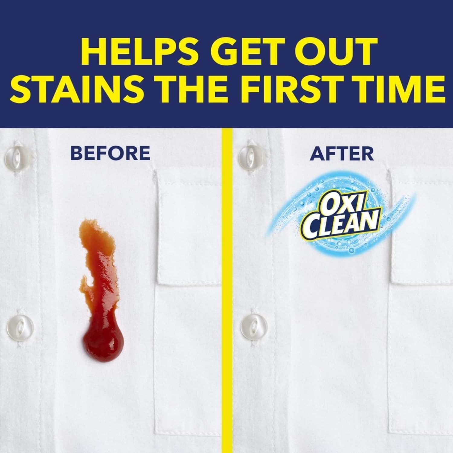 Multi-Purpose Stain Remover – Pack of 12, 12 fl oz Each