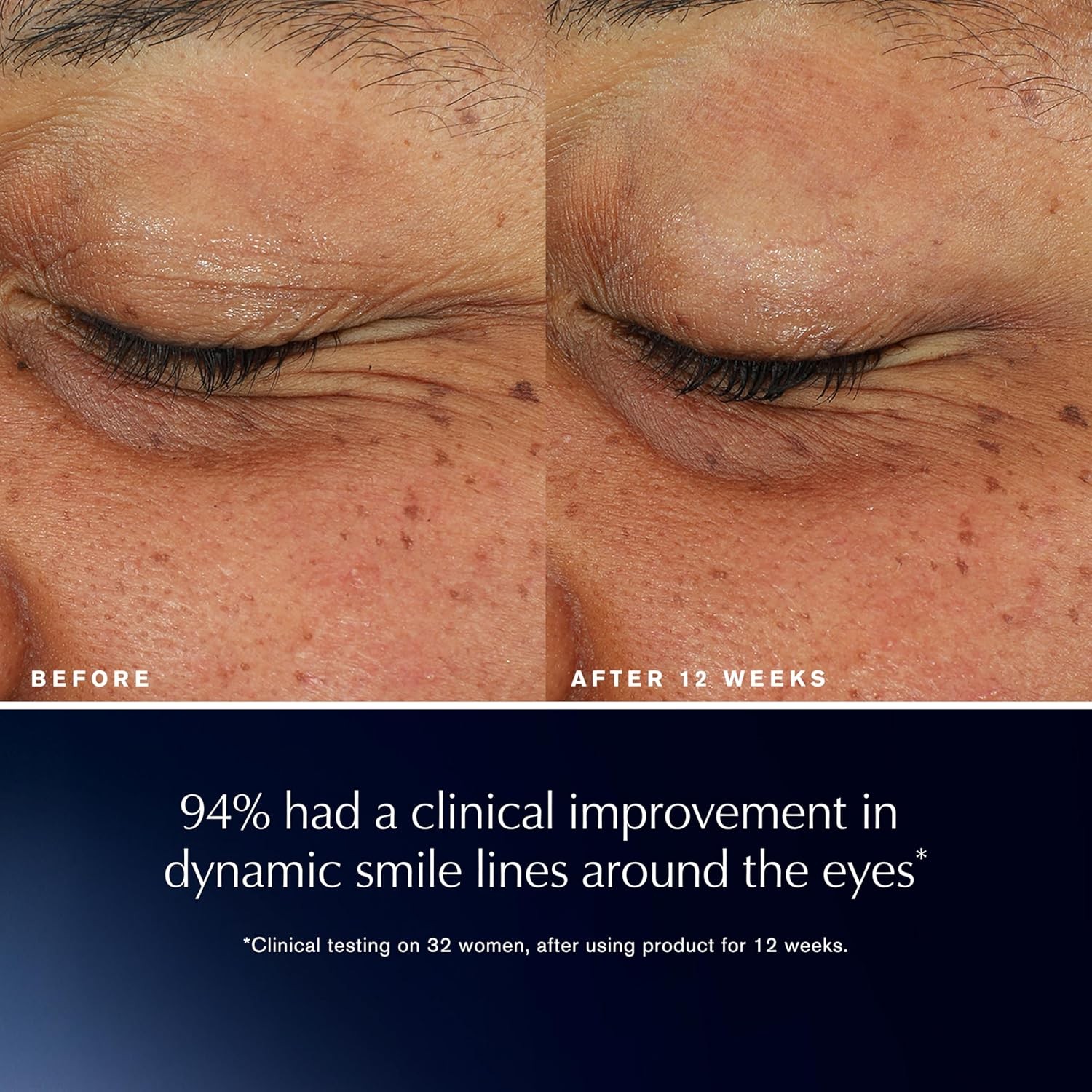 Est??e Lauder Advanced Night Repair Eye Lift + Sculpt | Eye Cream with 2HA Volu