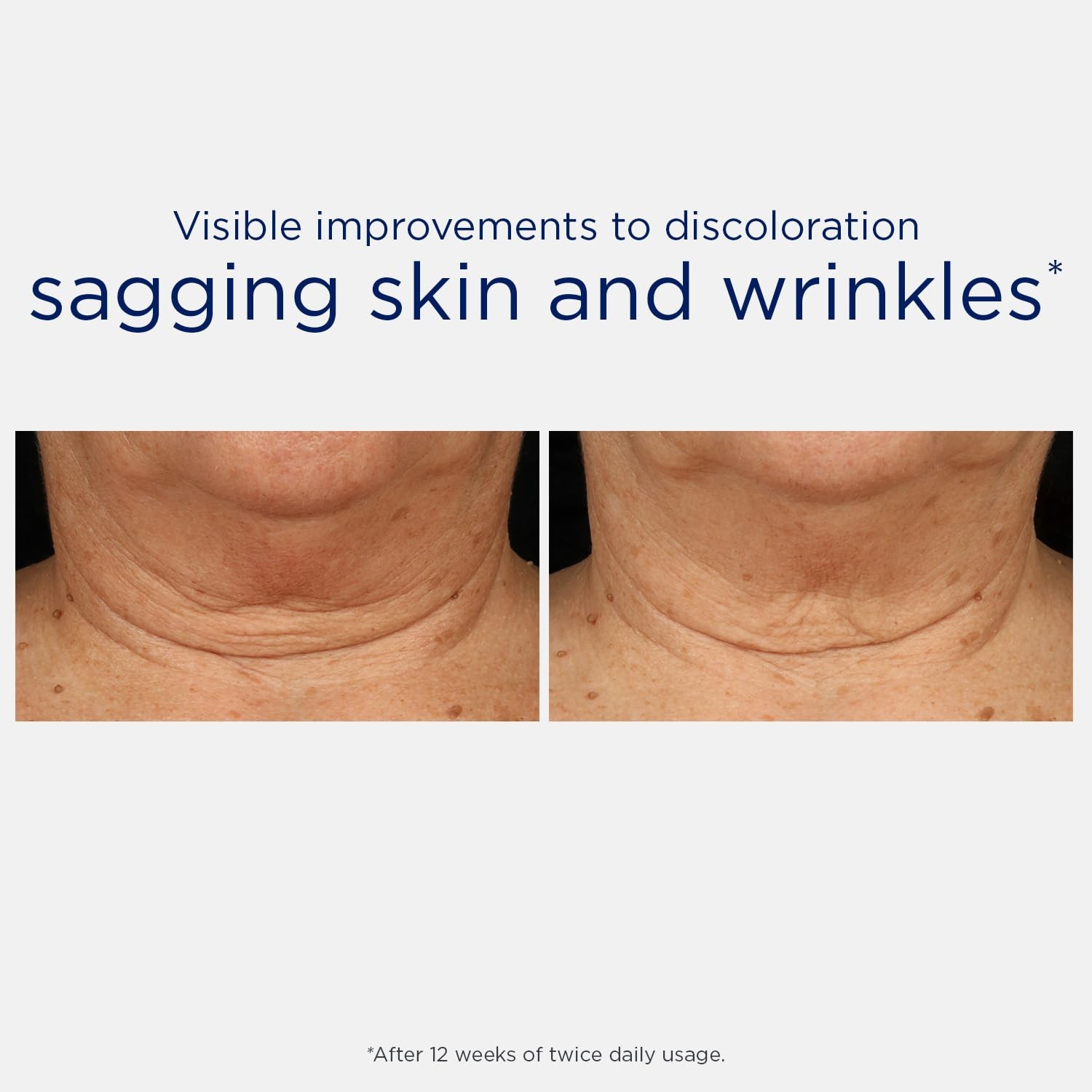 NEOSTRATA Triple Firming Neck Cream, New & Improved Formula – with MicroDiPept