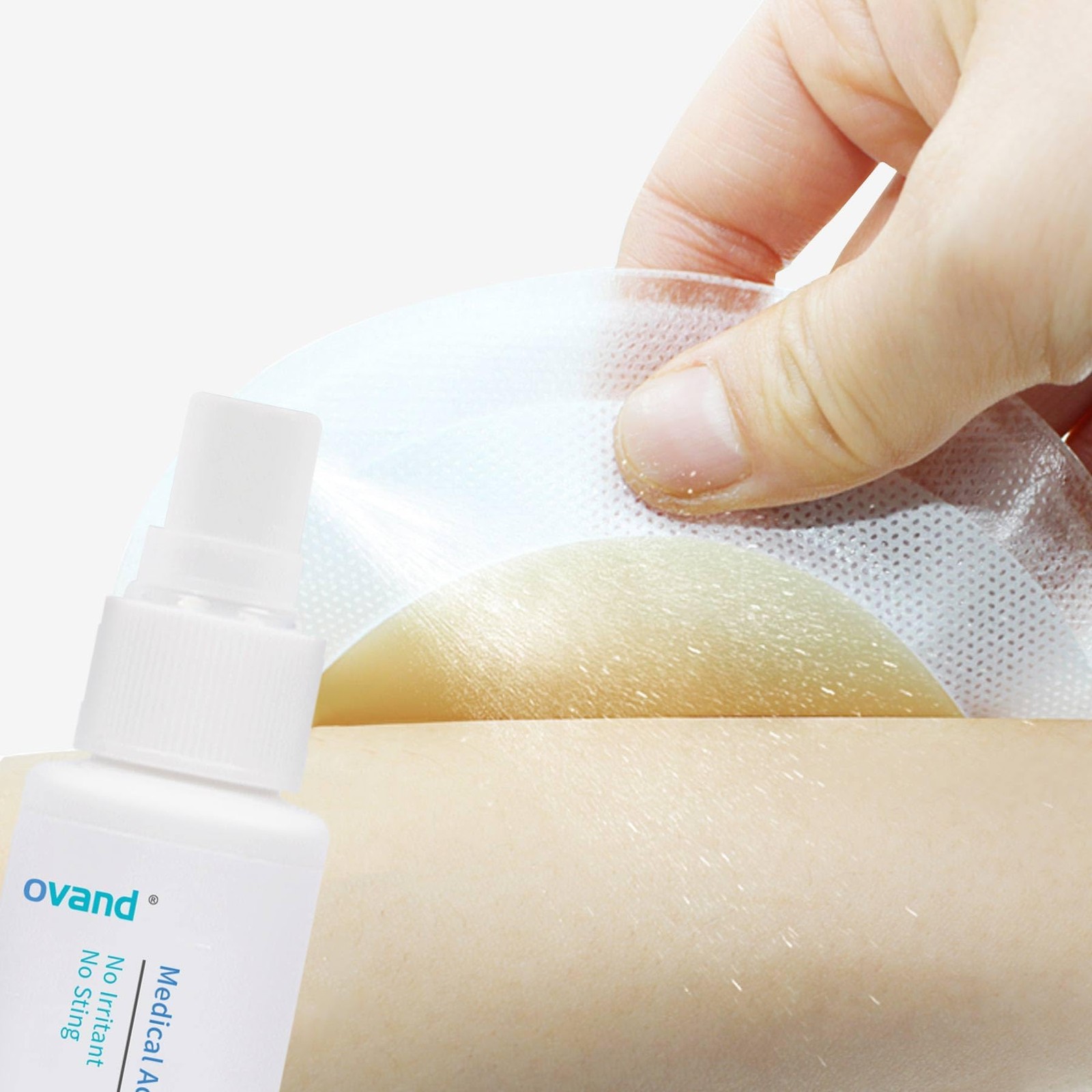 Medical Adhesive Remover Spray – 1 oz.No-Sting Ostomy Adhesive Remover Spray:…