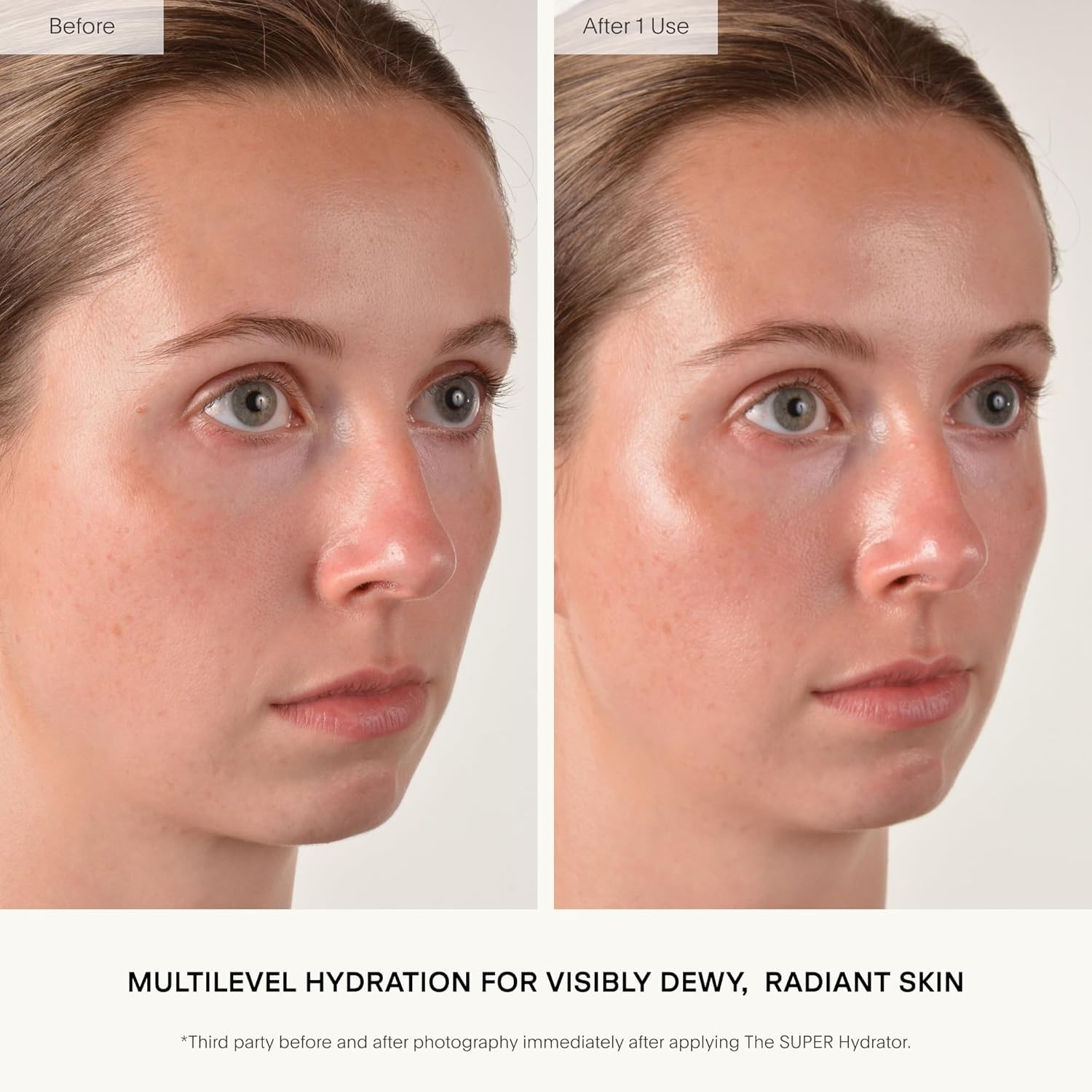 U Beauty The SUPER Hydrator – Mega-Dose Skin Hydrator and Hyaluronic Acid Mois