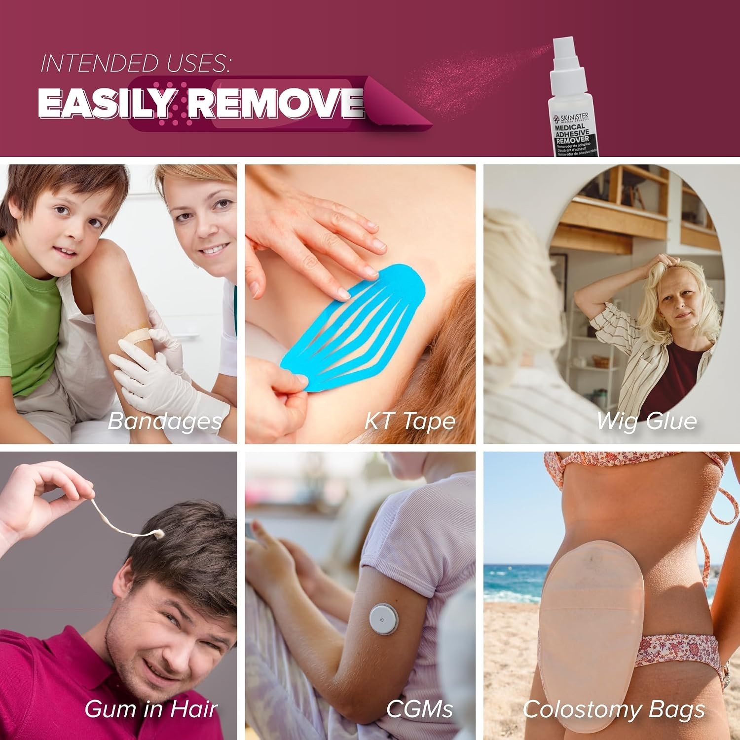 4oz Medical Adhesive Remover Spray Silicone Skin Safe Wig Tape Ostomy Remover12