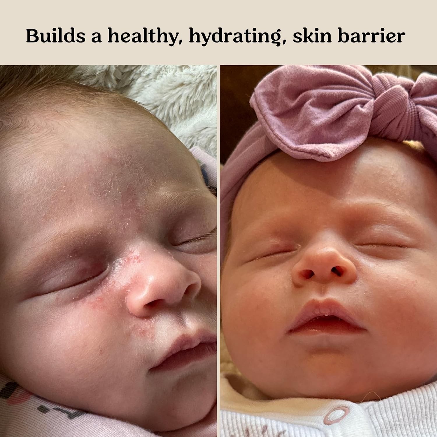 Roe Wellness Baby Cream & Baby Serum Power Pair Biome Barrier | For All Skin &