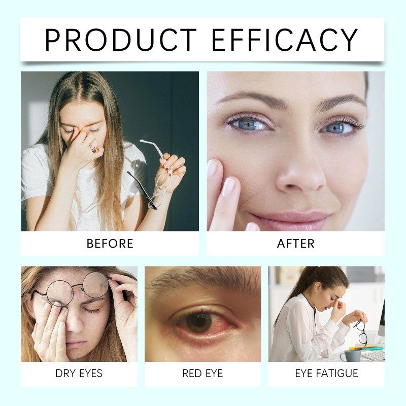 Nano Drops Eye Serum,Natural Nano Lubricant Eye for Drops Dry Eye Presbyopia.