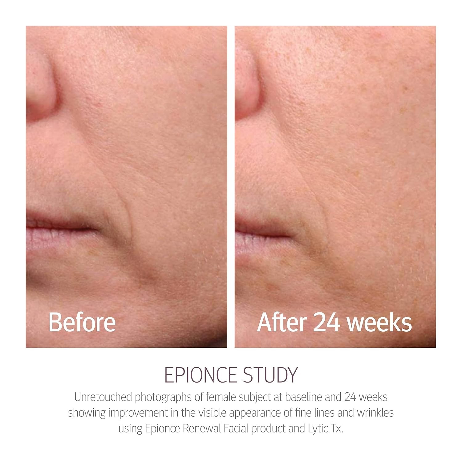 Epionce Renewal Facial Lotion – Hydrating, Anti-Aging Moisturizer for Normal t
