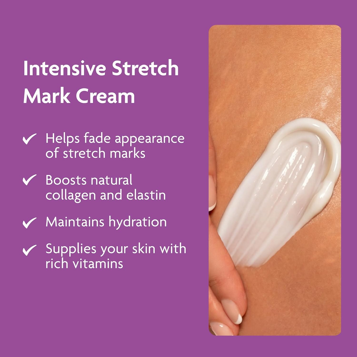 TriLASTIN Stretch Mark Cream ?C Collagen & Elastin Support Body Cream with Niac