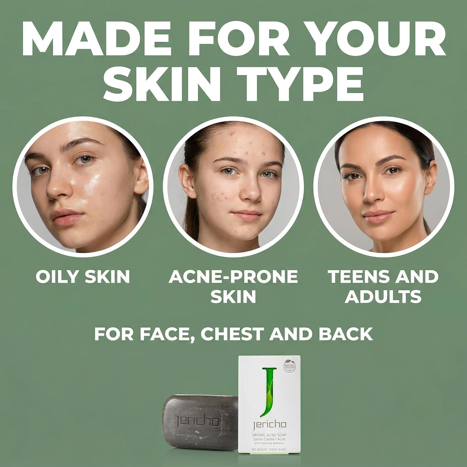Acne Drying Bar Soap Face, Chest & Ba – Dead Sea