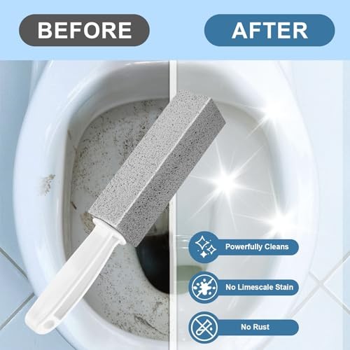 Toilet Pumice Stone With Handle, 5 Pack Pumice Stone Toilet Bowl Cleaner, Hard