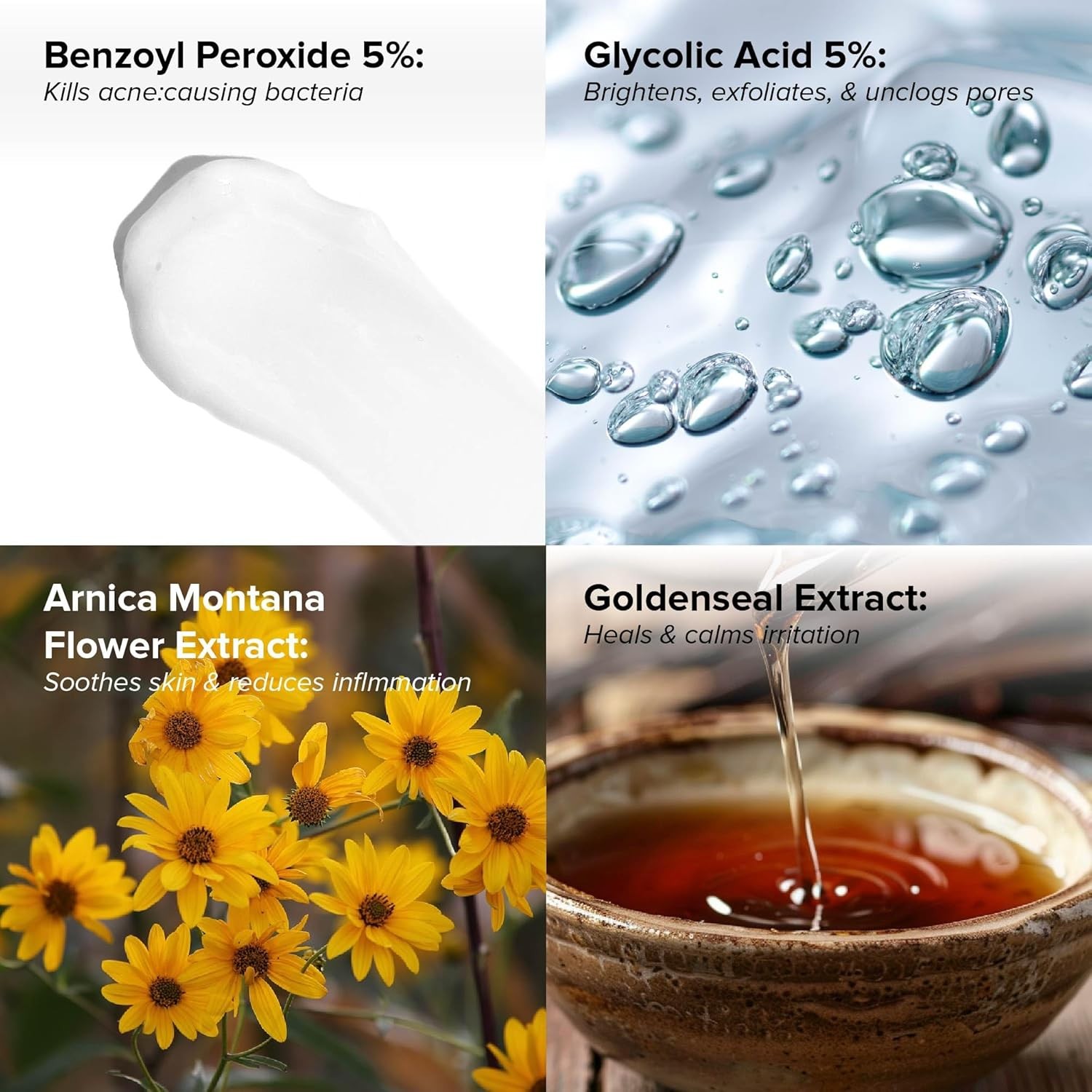 DRMTLGY Acne Spot Treatment and Cystic Acne Treatment. Acne Serum with Microni